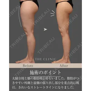 THE CLINIC（ザ・クリニック） 東京院 吉塚 将昭医師の症例