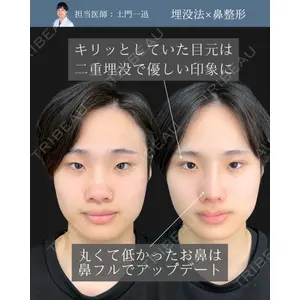 東京シンデレラ美容外科 新宿院 土門 一迅医師の症例