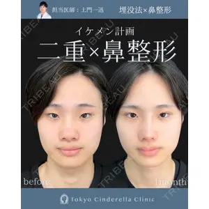 東京シンデレラ美容外科 新宿院 土門 一迅医師の症例