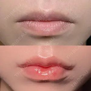 R Beauty CLINIC 銀座院 吉田　慧医師の症例