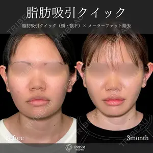 PRISM Beauty Clinic 畑山 知輝医師の症例