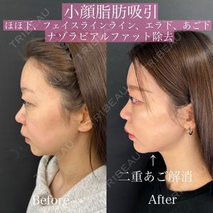 ルラ美容クリニック 渋谷本院 昼間 路子医師の症例