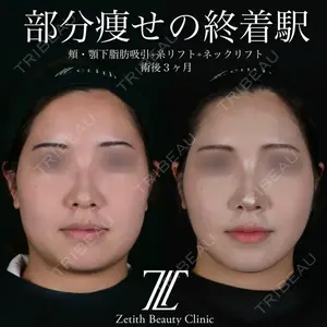 Zetith Beauty Clinic 池袋院 北村 翔医師の症例