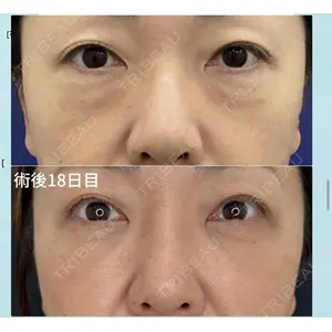 湘南美容クリニック 博多院 渥美 智晶医師の症例