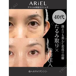 アリエル美容クリニック 大宮院 鈴木　桂介医師の症例