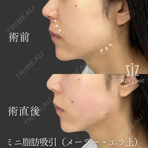 ziz CLINIC 村岡 史子医師の症例