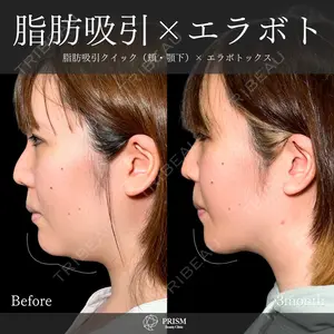 PRISM Beauty Clinic 畑山 知輝医師の症例