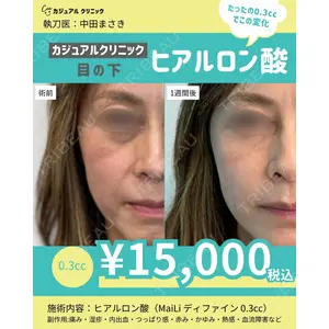カジュアルクリニック 平塚院の症例