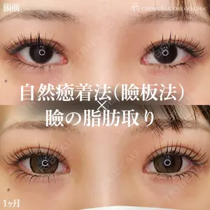 シンデレラ＆ダヴィンチクリニック 宮田 洋佑医師の症例
