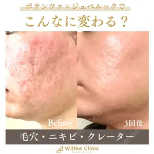 ウィルビークリニック 銀座院の症例