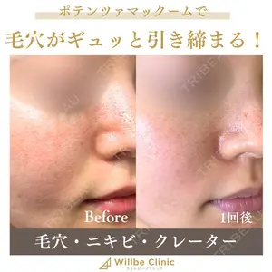 ウィルビークリニック 銀座院の症例