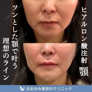 おおかみ美容のクリニック 新宿院 本郷 玲医師の症例