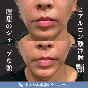 おおかみ美容のクリニック 新宿院 本郷 玲医師の症例