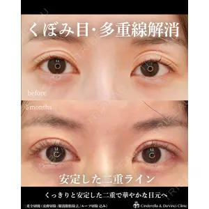 シンデレラ＆ダヴィンチクリニック 宮田 洋佑医師の症例