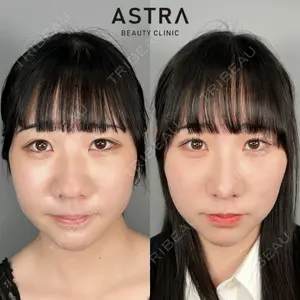 ASTRA BEAUTY CLINIC 塩満 惠子医師の症例