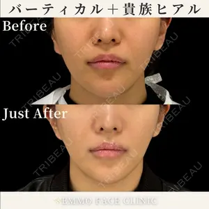 EMMO FACE CLINIC 東京三田院 木之下 哲彦医師の症例