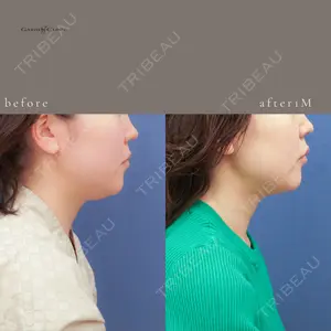 ガーデンクリニック 池袋院の症例