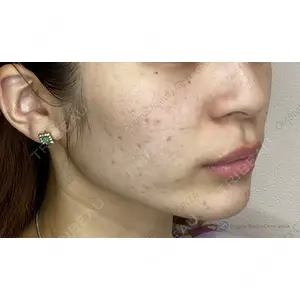 Original Beauty Clinic GINZA 佐藤玲史医師の症例