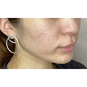 Original Beauty Clinic GINZA 佐藤玲史医師の症例