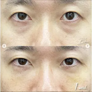 湘南美容クリニック 銀座院の症例