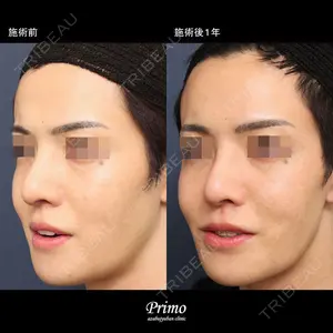 プリモ麻布十番クリニック 大場教弘医師の症例