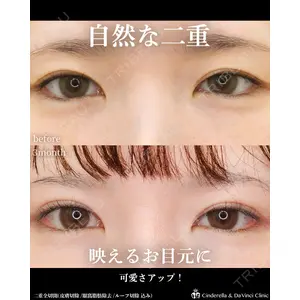 シンデレラ＆ダヴィンチクリニック 宮田 洋佑医師の症例