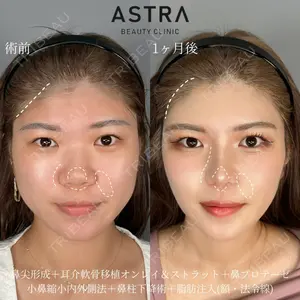 ASTRA BEAUTY CLINIC 塩満 惠子医師の症例
