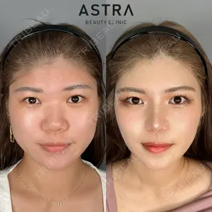 ASTRA BEAUTY CLINIC 塩満 惠子医師の症例