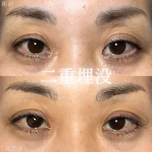 形成外科と美容外科のクリニック池袋 春日 航医師の症例
