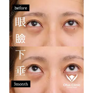 Otus Clinic 【オータスクリニック】 中 徳太郎医師の症例