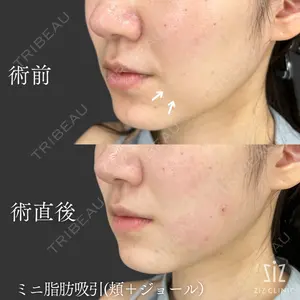 ziz CLINIC 村岡 史子医師の症例