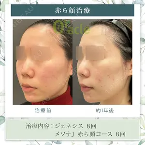 オラクル美容皮膚科 東京新宿院の症例