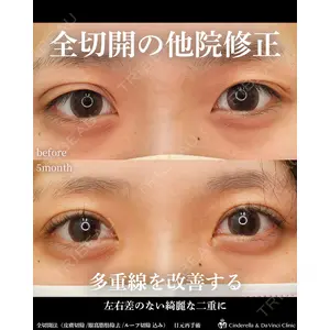 シンデレラ＆ダヴィンチクリニック 宮田 洋佑医師の症例