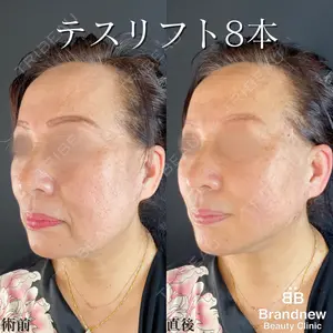 Brandnew Beauty Clinicの症例