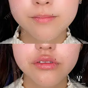 APスキンクリニック銀座 高麗 惠理医師の症例