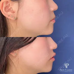 APスキンクリニック銀座 高麗 惠理医師の症例