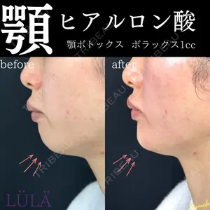 ルラ美容クリニック 新宿院 古市 まり江医師の症例