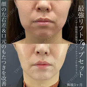 湘南美容クリニック 名古屋駅本院 豊嶋 沙良医師の症例