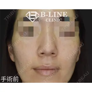 B-LINE CLINIC 池袋院 小池 康弘医師の症例