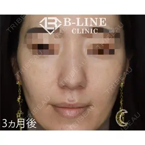 B-LINE CLINIC 池袋院 小池 康弘医師の症例