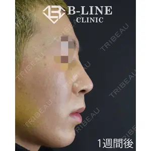 B-LINE CLINIC 池袋院 小池 康弘医師の症例