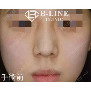 B-LINE CLINIC 池袋院 小池 康弘医師の症例