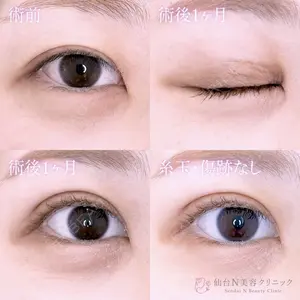 仙台N美容クリニック 小阪 捺稀医師の症例