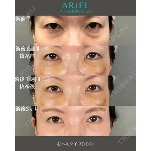 アリエル美容クリニック 大宮院 鈴木　桂介医師の症例