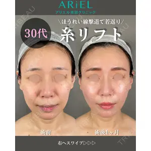アリエル美容クリニック 大宮院 鈴木　桂介医師の症例