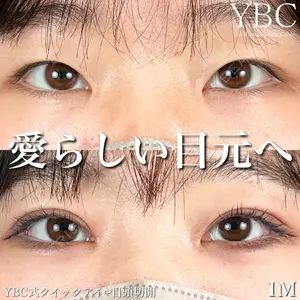 YBC横浜美容外科 大宮院 磯村 亮輔医師の症例
