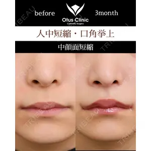 Otus Clinic 【オータスクリニック】 中 徳太郎医師の症例