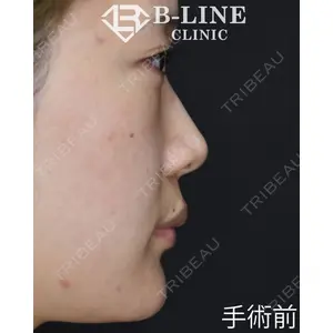 B-LINE CLINIC 池袋院 小池 康弘医師の症例