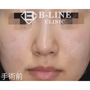 B-LINE CLINIC 池袋院 小池 康弘医師の症例