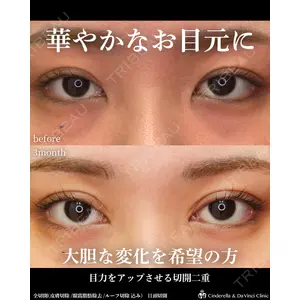 シンデレラ＆ダヴィンチクリニック 宮田 洋佑医師の症例